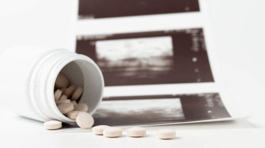Abortion pills, healthcare decision, pharmacy counter, medication for termination Geöffnete Medikamentendose mit Tabletten vor einem Ultraschallbild auf weißem Hintergrund.