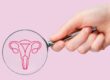 Hand hält eine Lupe, die eine stilisierte Illustration der Gebärmutter zeigt, vor einem rosa Hintergrund – Fokus auf weibliche Gesundheit.