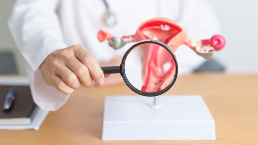 Arzt oder Ärztin hält eine Lupe über ein anatomisches Modell der weiblichen Gebärmutter auf einem Schreibtisch – Fokus auf gynäkologische Gesundheit.