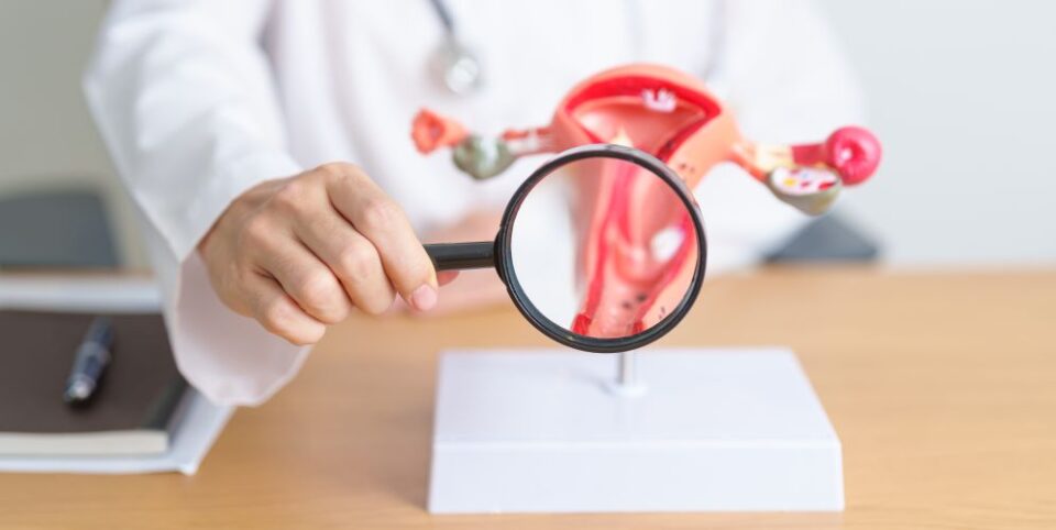 Arzt oder Ärztin hält eine Lupe über ein anatomisches Modell der weiblichen Gebärmutter auf einem Schreibtisch – Fokus auf gynäkologische Gesundheit.
