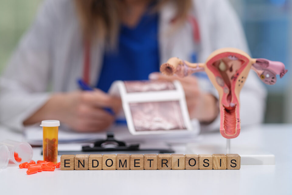 Endometriose-Konzept mit Modell des weiblichen Fortpflanzungssystems und Medikamenten